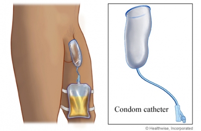 07-condom-catheter